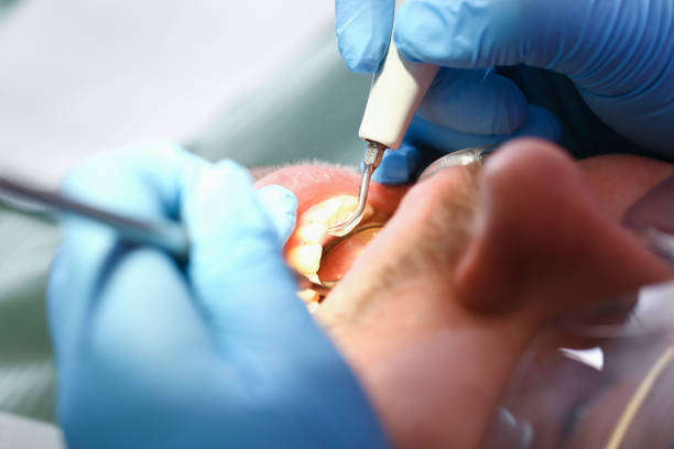 Best Emergency Root Canal Therapy in Woodsi East, DE